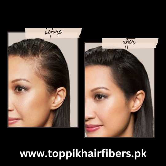 Toppik Hair Fibers Before & After