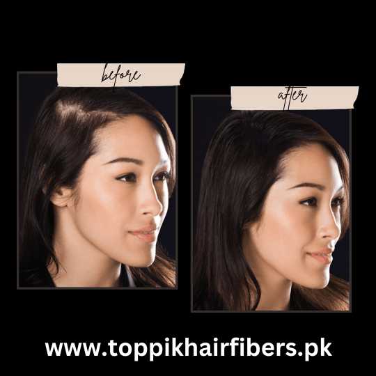 Toppik Hair Fibers Before & After